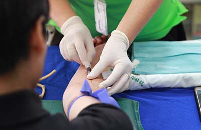 牙周病治疗办法